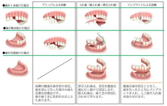 ubW/ꎕ/Cvg̔r}